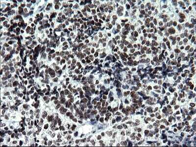 Immunohistochemistry: BMAL1 Antibody (OTI1H6) [NBP2-46544]