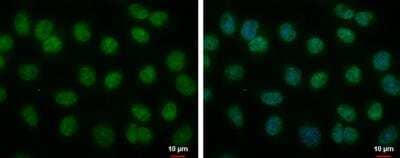 Immunocytochemistry/ Immunofluorescence: BMAL1 Antibody [NBP2-15599]