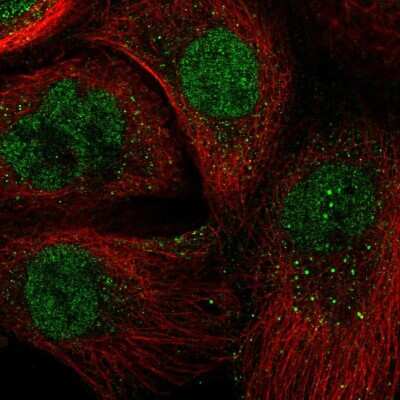 Immunocytochemistry/ Immunofluorescence: BMAL1 Antibody [NBP2-56754]