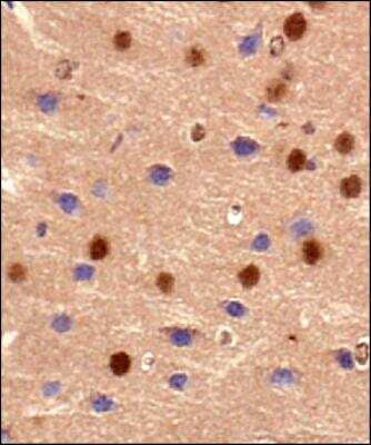 Immunohistochemistry: BMAL1 Antibody [NB100-2288]