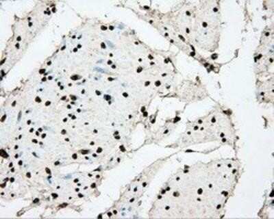 Immunohistochemistry: BMAL1 Antibody (OTI1C11) - Azide and BSA Free [NBP2-70207]