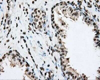 Immunohistochemistry: BMAL1 Antibody (OTI1C11) - Azide and BSA Free [NBP2-70207]