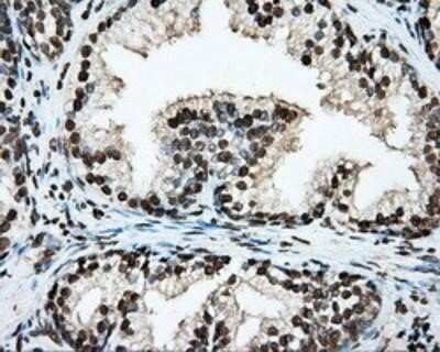 Immunohistochemistry-Paraffin: BMAL1 Antibody (OTI1C11) [NBP2-02544]