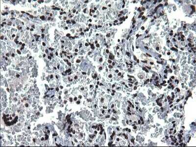 Immunohistochemistry: BMAL1 Antibody (OTI1H6) - Azide and BSA Free [NBP2-70208]
