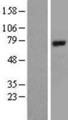 Western Blot: BMAL1 Overexpression Lysate [NBL1-07723]