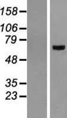 Western Blot: BMAL1 Overexpression Lysate [NBL1-07724]