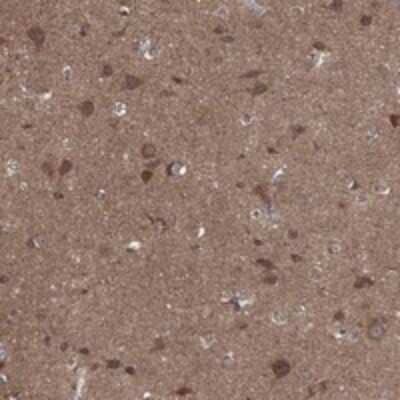 Immunohistochemistry-Paraffin: BMERB1 Antibody [NBP3-17471]