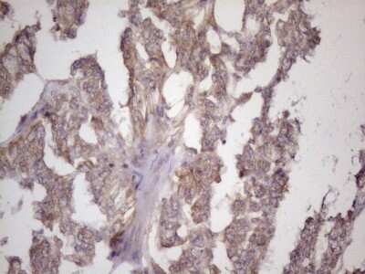 Immunohistochemistry: Bmf Antibody (OTI6F3) [NBP2-46578]