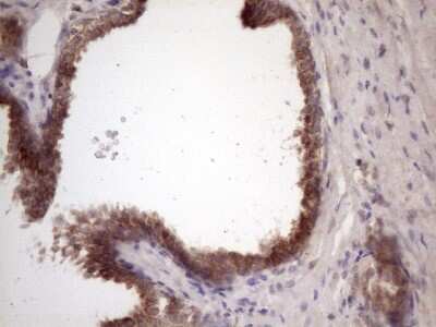 Immunohistochemistry: Bmf Antibody (OTI6F3) [NBP2-46578]