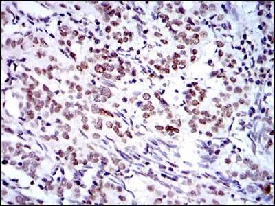 Immunohistochemistry-Paraffin: BMI-1 Antibody (3E3) - BSA Free [NBP2-22204]