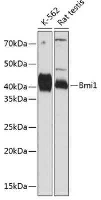 Western Blot: BMI-1 Antibody (6H9B0) [NBP3-15562]