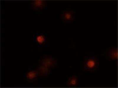 Immunocytochemistry/ Immunofluorescence: BMI-1 Antibody [NBP2-24693]