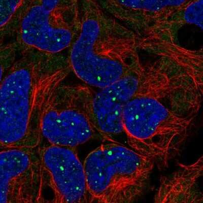 Immunocytochemistry/ Immunofluorescence: BMI-1 Antibody [NBP2-57552]