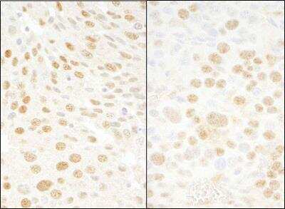 Immunohistochemistry-Paraffin: BMI-1 Antibody [NB100-87026]