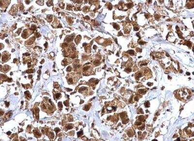 Immunohistochemistry-Paraffin: BMI-1 Antibody [NBP1-33748]