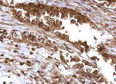 Immunohistochemistry-Paraffin: BMI-1 Antibody [NBP1-33748]