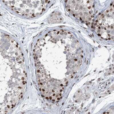 Immunohistochemistry-Paraffin: BMI-1 Antibody [NBP1-87321]
