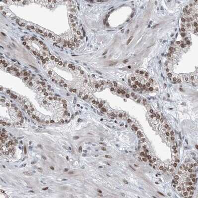 Immunohistochemistry-Paraffin: BMI-1 Antibody [NBP1-87321]