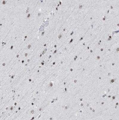 Immunohistochemistry-Paraffin: BMI-1 Antibody [NBP1-87321]