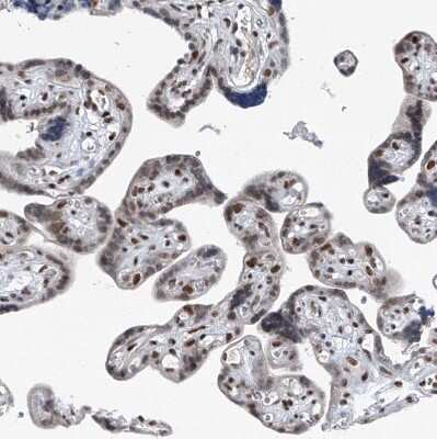 Immunohistochemistry-Paraffin: BMI-1 Antibody [NBP1-87321]