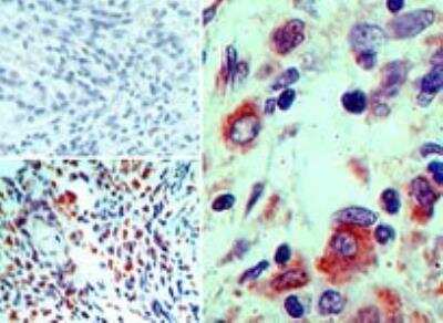 Immunohistochemistry-Paraffin: BMI-1 Antibody [NBP2-24693]