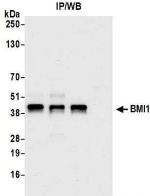 Immunoprecipitation: BMI-1 Antibody (BLR119H) [NBP3-14704]