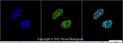 Immunocytochemistry/ Immunofluorescence: BMI-1 Antibody (LLBmi1-1) - Azide and BSA Free [NBP2-80599]