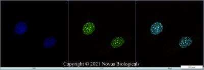 Immunocytochemistry/ Immunofluorescence: BMI-1 Antibody (LLBmi1-1) - Azide and BSA Free [NBP2-80599]