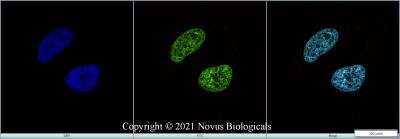 Immunocytochemistry/ Immunofluorescence: BMI-1 Antibody (LLBmi1-1) - BSA Free [NBP1-96140]