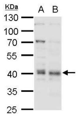 Western Blot: BMI-1 Antibody [NBP1-33748]