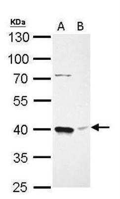 Western Blot: BMI-1 Antibody [NBP1-33748]