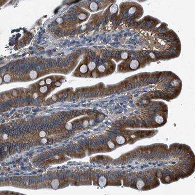 Immunohistochemistry: BMP-1/PCP Antibody [NBP1-87318]