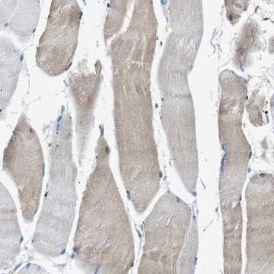 Immunohistochemistry-Paraffin: BMP-1/PCP Antibody [NBP1-87318]