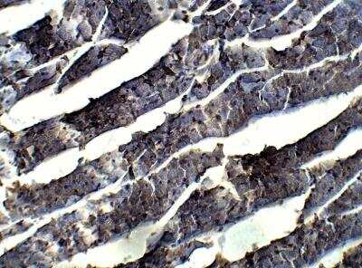 Immunohistochemistry-Paraffin: BMP-1/PCP Antibody [NBP3-12290]