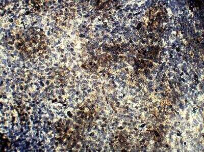 Immunohistochemistry-Paraffin: BMP-1/PCP Antibody [NBP3-12290]