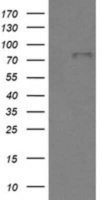 Western Blot: BMP-1/PCP Antibody (OTI3E9) [NBP2-46579]