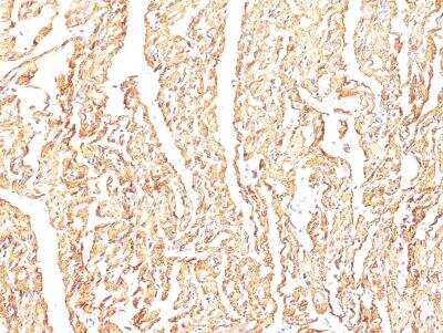 Immunohistochemistry-Paraffin: BMP-10 Antibody [NBP2-99411]