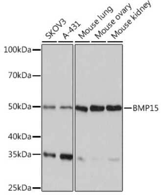 Western Blot: BMP-15/GDF-9B Antibody (6K5C3) [NBP3-16342]