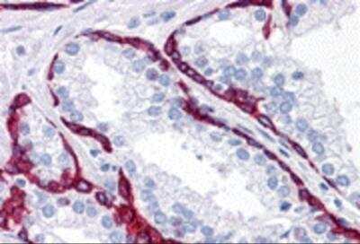 Immunohistochemistry: BMP-15/GDF-9B Antibody - BSA Free [NBP2-81743]