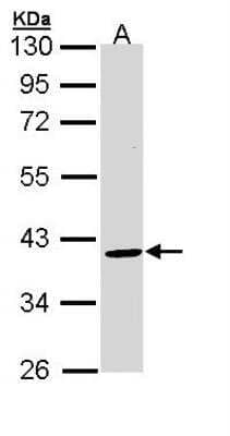 Western Blot: BMP-15/GDF-9B Antibody [NBP2-14888]