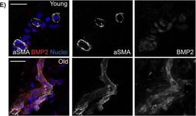 Immunohistochemistry: BMP-2 Antibody - BSA Free [NBP1-19751]