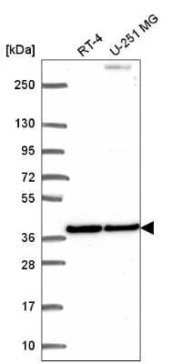 Western Blot: BMP-2 Antibody [NBP2-56251]