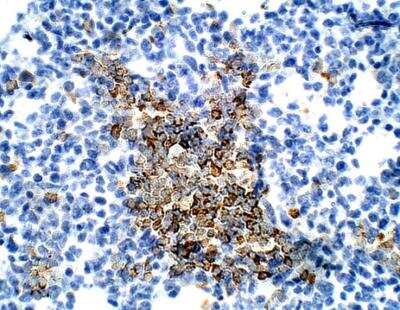Immunohistochemistry-Paraffin: BMP-2/BMP-4 Antibody [NBP3-12507]