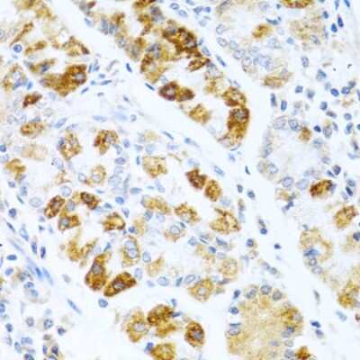 Immunohistochemistry-Paraffin: BMP-3 Antibody - BSA Free [NBP2-92799]