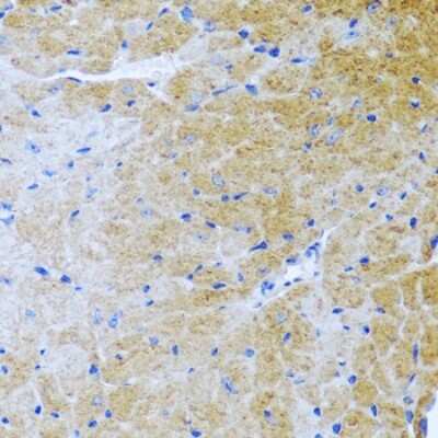Immunohistochemistry-Paraffin: BMP-3 Antibody - BSA Free [NBP2-92799]