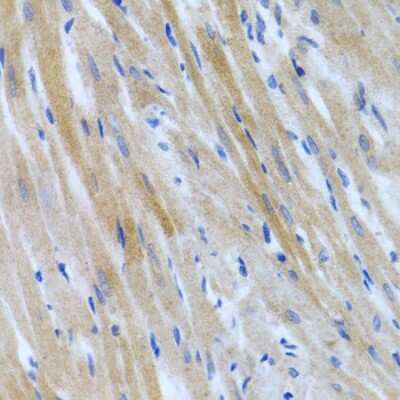 Immunohistochemistry-Paraffin: BMP-3 Antibody - BSA Free [NBP2-92799]