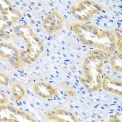 Immunohistochemistry-Paraffin: BMP-3 Antibody - BSA Free [NBP2-92799]