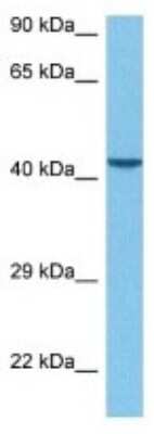 Western Blot: BMP-3 Antibody [NBP3-10785]