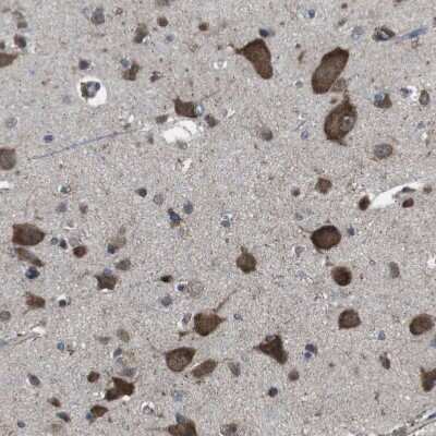 Immunohistochemistry-Paraffin: BMP-3b/GDF-10 Antibody [NBP1-88574]