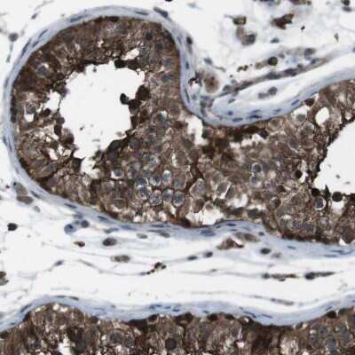 Immunohistochemistry-Paraffin: BMP-3b/GDF-10 Antibody [NBP1-88574]